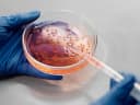 Ricercatore che pipetta una coltura di cellule staminali in una piastra Petri